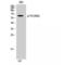 Tyrosine Hydroxylase antibody, LS-C381196, Lifespan Biosciences, Western Blot image 