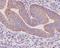 Sonic hedgehog protein antibody, M00058, Boster Biological Technology, Immunohistochemistry frozen image 