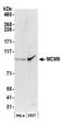 DNA replication licensing factor MCM6 antibody, A300-127A, Bethyl Labs, Western Blot image 
