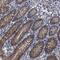 Endoplasmic Reticulum Metallopeptidase 1 antibody, PA5-54237, Invitrogen Antibodies, Immunohistochemistry paraffin image 
