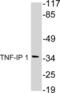 TNF Alpha Induced Protein 1 antibody, LS-C192036, Lifespan Biosciences, Western Blot image 