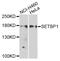 SET Binding Protein 1 antibody, STJ29292, St John