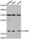 Stathmin 1 antibody, orb135827, Biorbyt, Western Blot image 