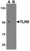 Toll Like Receptor 9 antibody, A00198-2, Boster Biological Technology, Western Blot image 