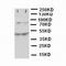 Minichromosome Maintenance Complex Component 3 antibody, LS-C312806, Lifespan Biosciences, Western Blot image 