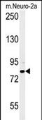 Cytoplasmic Polyadenylation Element Binding Protein 4 antibody, GTX02529, GeneTex, Western Blot image 