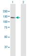 Cell Migration Inducing Hyaluronidase 1 antibody, H00057214-D01P, Novus Biologicals, Western Blot image 