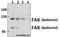 Protein Tyrosine Kinase 2 antibody, A00151, Boster Biological Technology, Western Blot image 