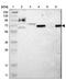 NADP-dependent malic enzyme antibody, NBP1-86129, Novus Biologicals, Western Blot image 