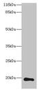 RAB30, Member RAS Oncogene Family antibody, CSB-PA613602LA01HU, Cusabio, Western Blot image 