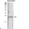 Interleukin 22 antibody, LS-C814162, Lifespan Biosciences, Western Blot image 