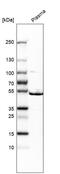ST3 Beta-Galactoside Alpha-2,3-Sialyltransferase 1 antibody, HPA040466, Atlas Antibodies, Western Blot image 