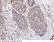 BMPR1A antibody, 10446-T24, Sino Biological, Immunohistochemistry paraffin image 
