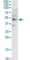 SH3 Domain Containing GRB2 Like 1, Endophilin A2 antibody, H00006455-M02, Novus Biologicals, Western Blot image 