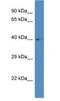 Aspartylglucosaminidase antibody, NBP1-79881, Novus Biologicals, Western Blot image 