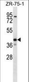 Potassium Two Pore Domain Channel Subfamily K Member 1 antibody, LS-C165438, Lifespan Biosciences, Western Blot image 