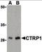 C1q And TNF Related 1 antibody, orb86698, Biorbyt, Western Blot image 