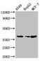 CCAAT Enhancer Binding Protein Alpha antibody, CSB-PA005180HA01HU, Cusabio, Western Blot image 