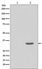 Cyclin Dependent Kinase 2 antibody, P00166, Boster Biological Technology, Western Blot image 