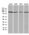 Phosphoinositide Kinase, FYVE-Type Zinc Finger Containing antibody, LS-C795426, Lifespan Biosciences, Western Blot image 