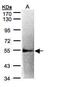 Interleukin 2 Receptor Subunit Beta antibody, PA5-28835, Invitrogen Antibodies, Western Blot image 