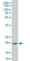 Indian Hedgehog Signaling Molecule antibody, LS-C197507, Lifespan Biosciences, Western Blot image 