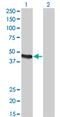 Carboxypeptidase A2 antibody, MA5-18635, Invitrogen Antibodies, Western Blot image 
