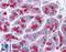 ELOVL Fatty Acid Elongase 7 antibody, LS-B4637, Lifespan Biosciences, Immunohistochemistry paraffin image 