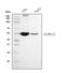 Aldehyde Dehydrogenase 1 Family Member A1 antibody, M01392-2, Boster Biological Technology, Western Blot image 