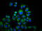 Transient Receptor Potential Cation Channel Subfamily M Member 3 antibody, LS-C681612, Lifespan Biosciences, Immunofluorescence image 