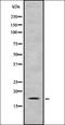Holliday Junction Recognition Protein antibody, orb337738, Biorbyt, Western Blot image 