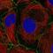 Plakophilin 2 antibody, NBP2-58748, Novus Biologicals, Immunocytochemistry image 