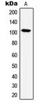 Heat Shock Protein Family H (Hsp110) Member 1 antibody, LS-C353291, Lifespan Biosciences, Western Blot image 