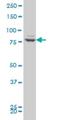 Zinc Finger Protein 263 antibody, H00010127-M03, Novus Biologicals, Western Blot image 