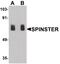 Sphingolipid Transporter 1 (Putative) antibody, PA5-38050, Invitrogen Antibodies, Western Blot image 