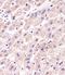 Protein Phosphatase 2 Regulatory Subunit Balpha antibody, MBS9214877, MyBioSource, Immunohistochemistry paraffin image 