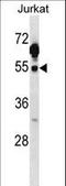 C-Terminal Src Kinase antibody, LS-C164351, Lifespan Biosciences, Western Blot image 