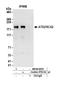 ATX2 antibody, NB100-58797, Novus Biologicals, Western Blot image 