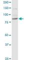 Ribonucleotide Reductase Catalytic Subunit M1 antibody, H00006240-M04, Novus Biologicals, Western Blot image 