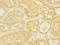 Amiloride-sensitive cation channel 3 antibody, LS-C675396, Lifespan Biosciences, Immunohistochemistry paraffin image 