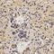 Family With Sequence Similarity 160 Member B2 antibody, GTX54018, GeneTex, Immunohistochemistry paraffin image 