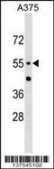 Carnosine Dipeptidase 1 antibody, 59-369, ProSci, Western Blot image 