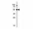 AKT Serine/Threonine Kinase 3 antibody, F50045-0.4ML, NSJ Bioreagents, Immunohistochemistry frozen image 