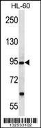 Protocadherin Alpha 12 antibody, 56-876, ProSci, Western Blot image 