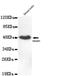 SMAD Family Member 5 antibody, GTX49219, GeneTex, Western Blot image 