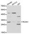 Regulator Of Calcineurin 1 antibody, TA332613, Origene, Western Blot image 