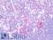 Telomerase Reverse Transcriptase antibody, LS-B9932, Lifespan Biosciences, Immunohistochemistry frozen image 
