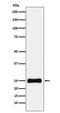 Proteasome Subunit Alpha 2 antibody, M08901-1, Boster Biological Technology, Western Blot image 