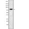 Phosphatidylinositol Glycan Anchor Biosynthesis Class Q antibody, abx217768, Abbexa, Western Blot image 