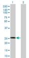 Glutathione S-Transferase Omega 2 antibody, H00119391-D01P, Novus Biologicals, Western Blot image 